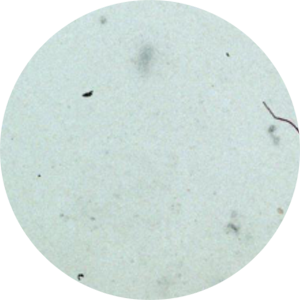 Application Foci Assay: Gesamtansicht der Well-Platte